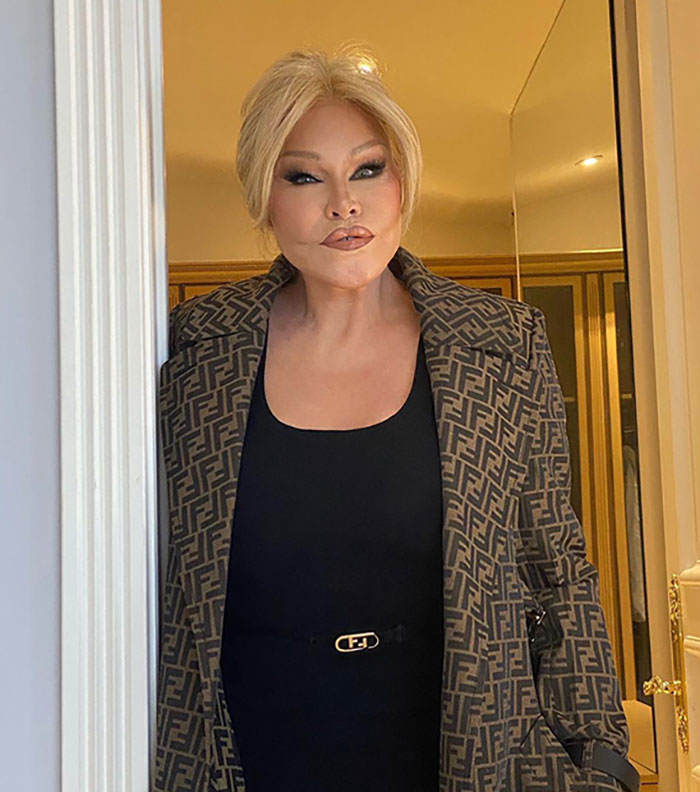 &lsquo;Catwoman&rsquo; Jocelyn Wildenstein Reveals Her Original Face In Stunning Throwback Post