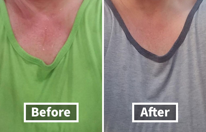 Sweaty Palms Making Handshakes Awkward? Wipe Away The Worry With These Sweatblock Max Clinical Antiperspirant Wipes - Your Handshake Will Be Firm And Dry, Just Like Your Confidence