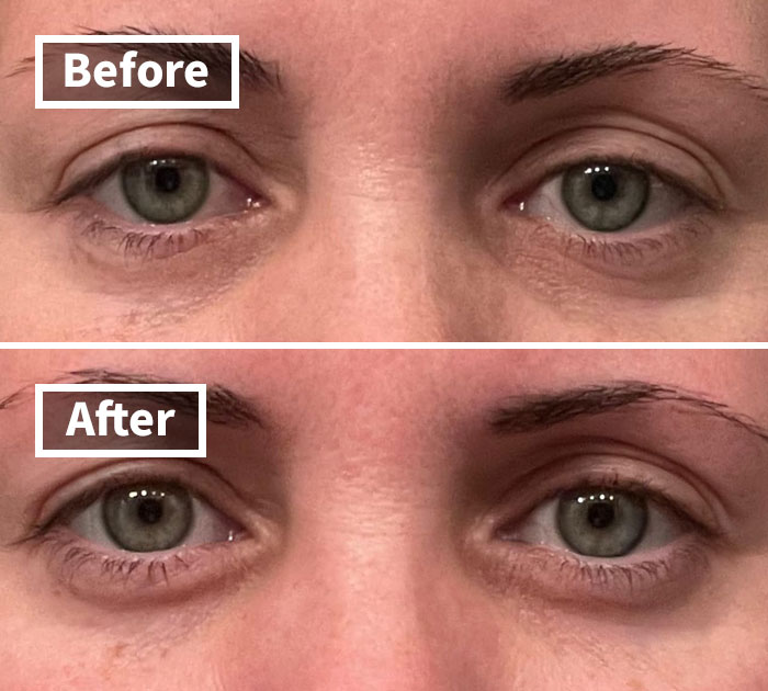 Late Nights Got Your Eyes Looking Like You've Been Crying Over Spilled Milk? CeraVe Eye Repair Cream Will Have You Looking Bright-Eyed And Bushy-Tailed In No Tim