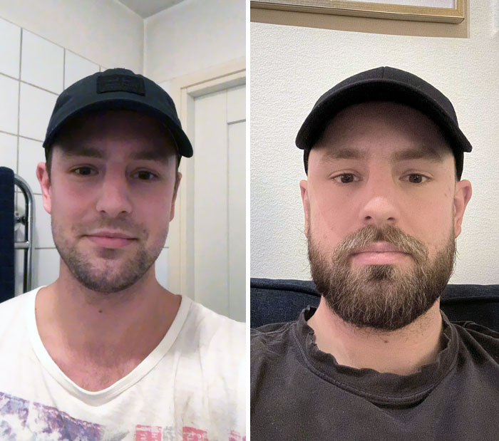 Should I Keep The Beard Or Shave It?