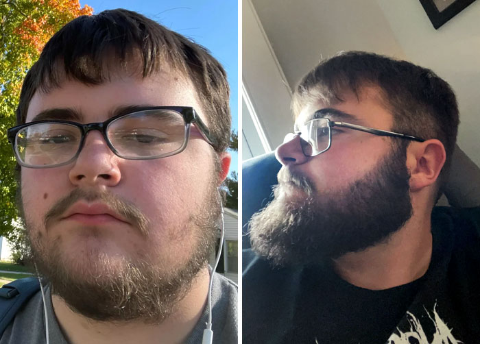 Beard Progression Over Almost A Year. I Was 15 In The First Picture, And Now I'm 16