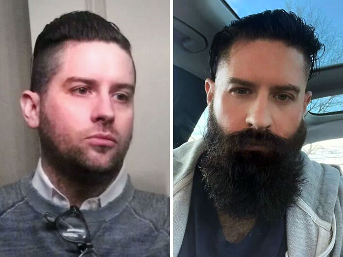 My Beard Is Already 10 Years Old