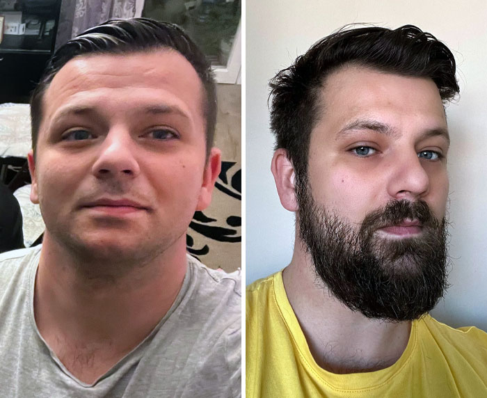 From Shaved To Trimmed To Full On Sparta Mode. Should I Continue Or Let It Get Faded Again?