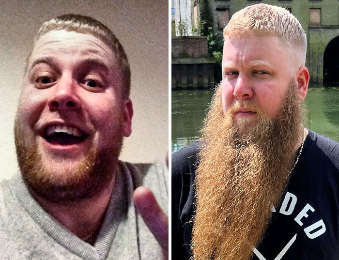 Before vs. After. I Used To Smile A Lot More Back Then