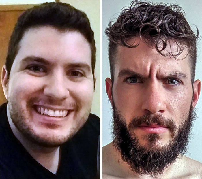Before And After I Grew A Normal Beard
