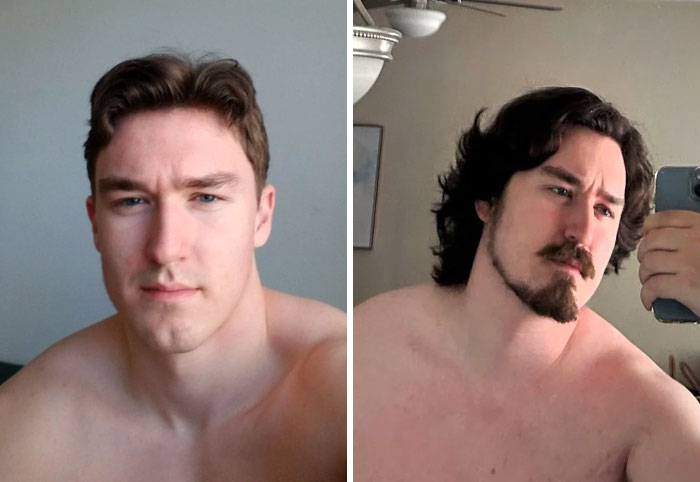 Shaven vs. Some Hair. Should I Go Back Or Keep It?