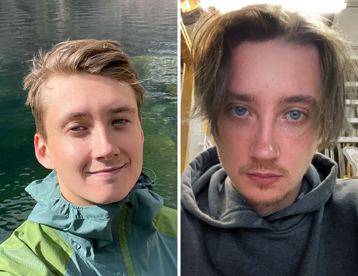 I'm 26 Years Old, And I've Always Had A Baby Face, But Now I Grew A Little Beard. Before vs. After