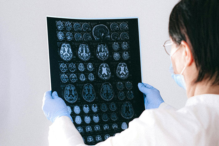 Flu Or Fatal: People Are Sharing Their Wildest Misdiagnosis Stories