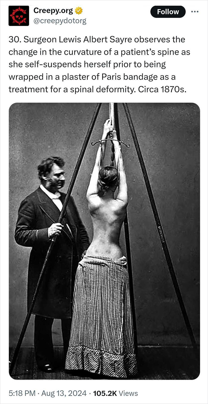 Medical-Treatments-Through-History-Pics