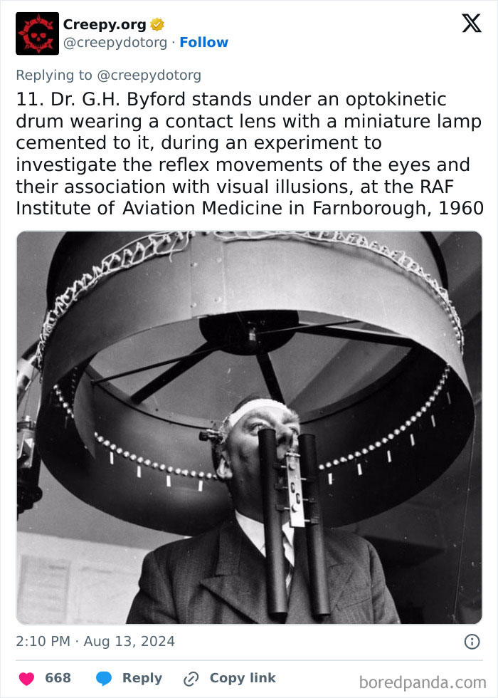 Medical-Treatments-Through-History-Pics