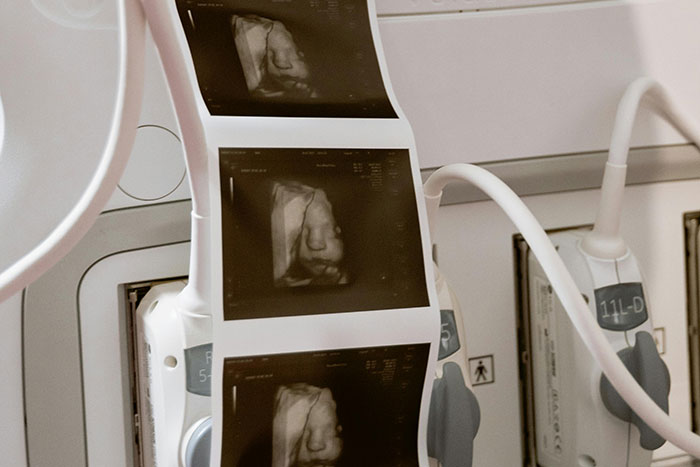 “I Lost So Much Respect For Him”: 50 People Share The Reason They Didn’t Marry Their Partner