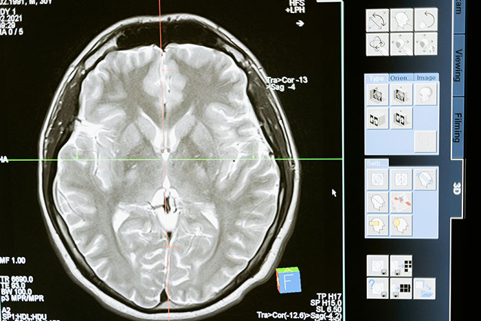 50 People Share The Most Bone-Chilling Medical Facts That Might Give You Goosebumps