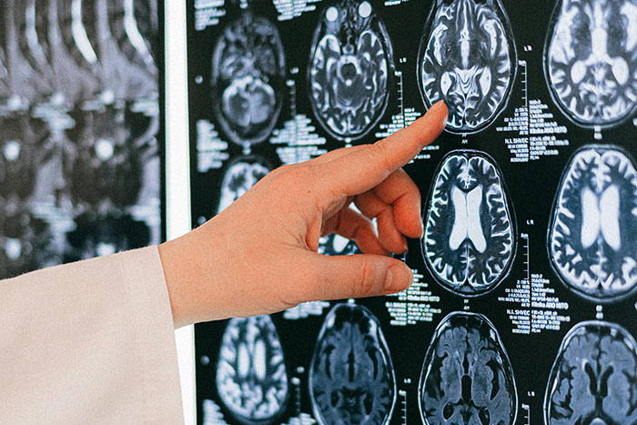 50 People Share The Most Bone-Chilling Medical Facts That Might Give You Goosebumps