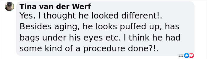 Tom Cruise’s Olympics Stunt Overshadowed By His “New Face” Tom Cruise’s Olympics Stunt Overshadowed By His “New Face”