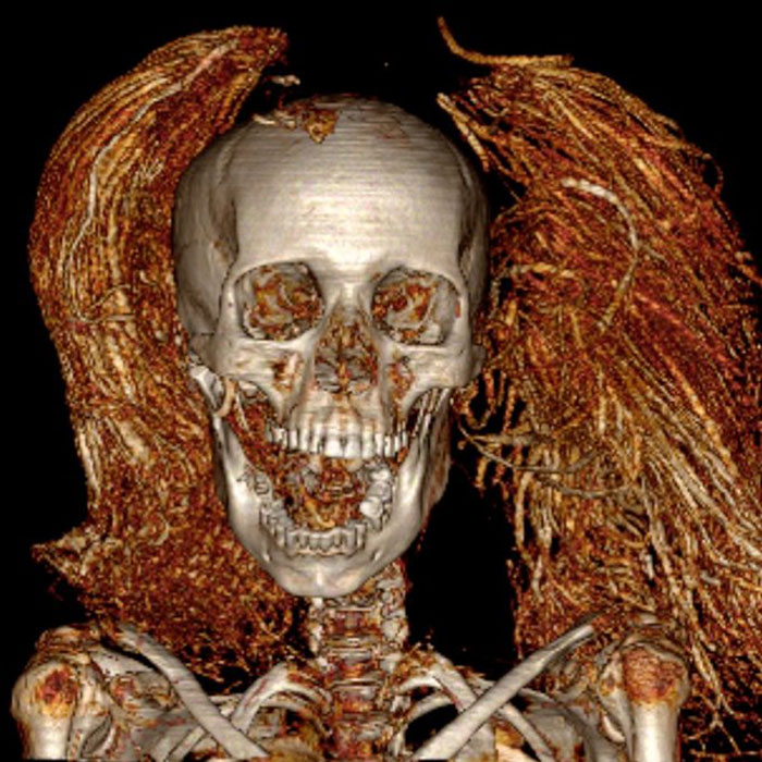 &ldquo;So Horrible&rdquo;: Virtual Autopsy Reveals Ancient Egyptian Mummy&rsquo;s Heart-Wrenching Secret