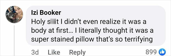 Woman Hospitalized After Liposuction Procedure Using AliExpress Dental Phlegm Suction Machine Woman Hospitalized After Liposuction Procedure Using AliExpress Dental Phlegm Suction Machine