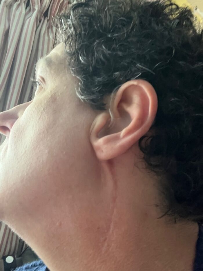 30 Times People Didn’t Think Their Symptoms Were A Big Deal, But They Were