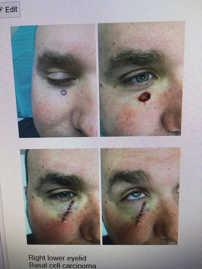 30 Times People Didn’t Think Their Symptoms Were A Big Deal, But They Were