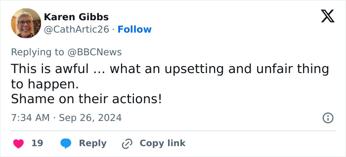 "Scaring The Customers": Man Says Restaurant Threw Him Out Because Of His Facial Disfigurement "Scaring The Customers": Man Says Restaurant Threw Him Out Because Of His Facial Disfigurement