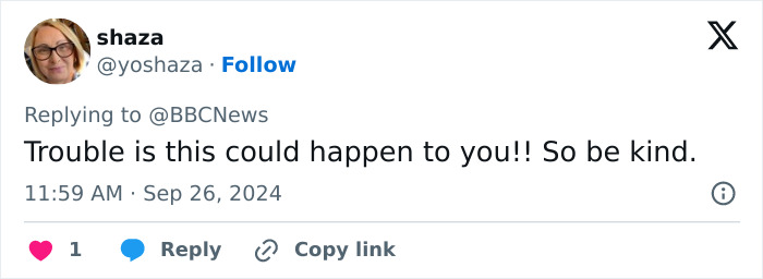 "Scaring The Customers": Man Says Restaurant Threw Him Out Because Of His Facial Disfigurement "Scaring The Customers": Man Says Restaurant Threw Him Out Because Of His Facial Disfigurement