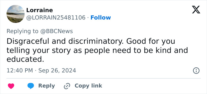 "Scaring The Customers": Man Says Restaurant Threw Him Out Because Of His Facial Disfigurement "Scaring The Customers": Man Says Restaurant Threw Him Out Because Of His Facial Disfigurement