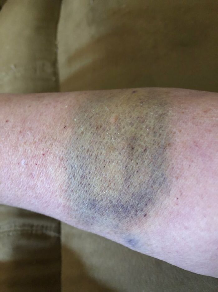 30 Times People Didn’t Think Their Symptoms Were A Big Deal, But They Were