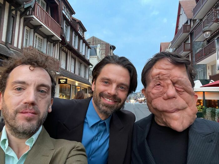 &ldquo;My Disability Has Opened Doors&rdquo;: Actor Adam Pearson Wants To Normalize Facial Disfigurement