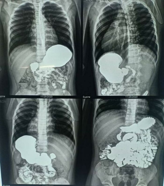 50 Times People Tasted Something Unusual Whether On Purpose Or By Accident