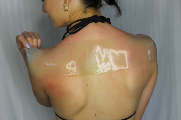 This Aloe Wrap Is The Post-Beach Essential You Didn't Know You Needed 