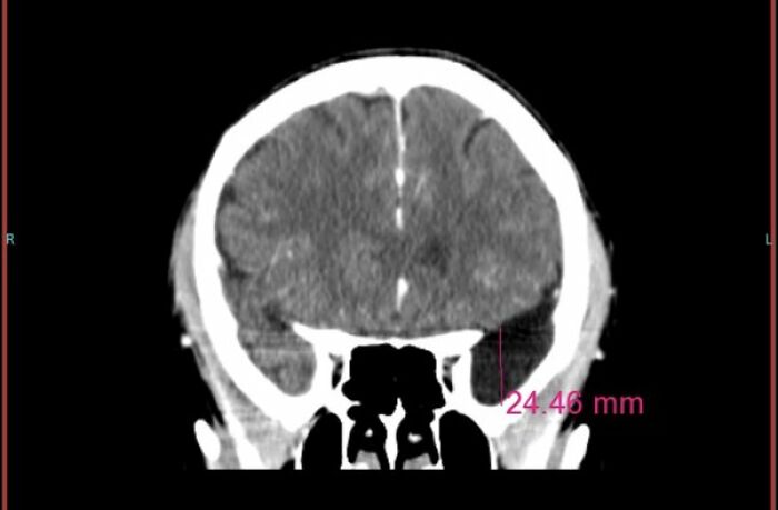 30 Times People Didn’t Think Their Symptoms Were A Big Deal, But They Were