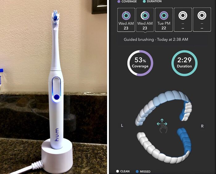 Your Pearly Whites Are About To Get A Tech Upgrade! This Hum By Colgate Smart Battery Toothbrush Kit Will Make You Feel Like A Dental Superhero
