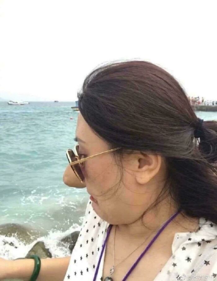 Confusing pic of a woman at the beach with sunglasses, appearing to have a nose enlargement due to angle.