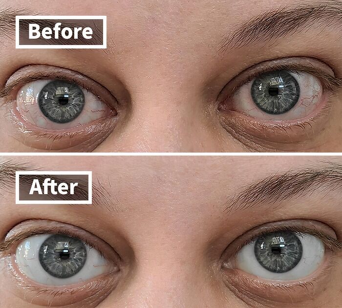 These Redness Reliever Eye Drops Are The Real MVP - They'll Have Your Eyes Looking Less Like A Horror Movie And More Like A Rom-Com