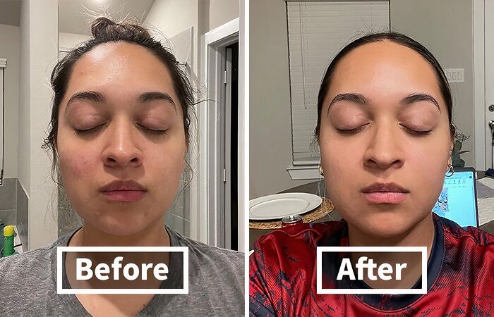 Don't Let Breakouts Steal Your Spotlight! This Skinsmart Facial Cleanser Is The Hidden Gem That Will Have Your Skin Glowing Brighter Than A Disco Ball