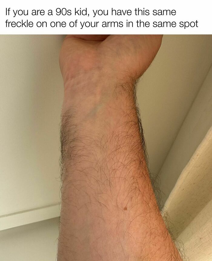 Close-up of a forearm with a freckle, referencing nostalgia for 90s kids and childhood memories.