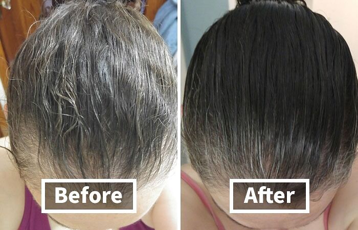 Boost Your Hair Care Routine With Biotin Shampoo For Thinning Hair: Helps Strengthen And Nourish For Fuller, Healthier Locks