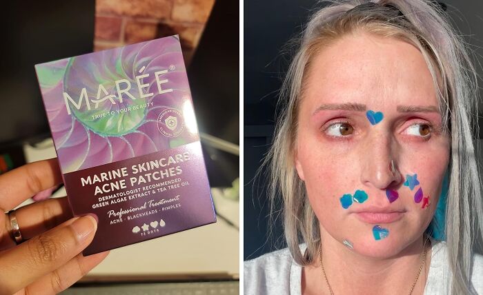 Zits And Breakouts Are Officially Cancelled! These Acne Patches Are The Skincare Superheroes We All Deserve