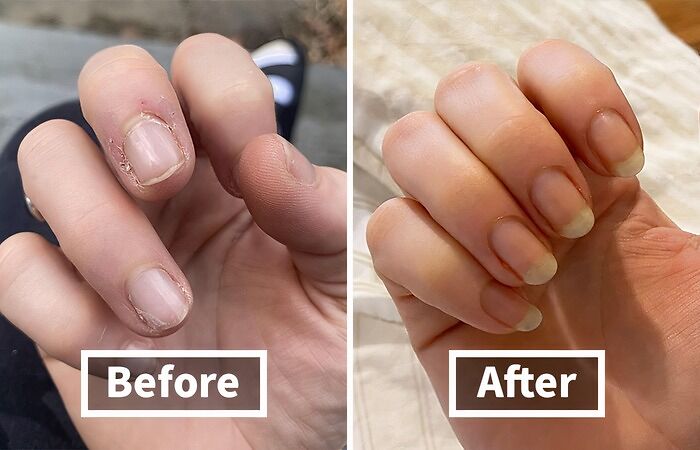 Before and after comparison of nails showing the effectiveness of items that fix everyday annoyances in a cool way.