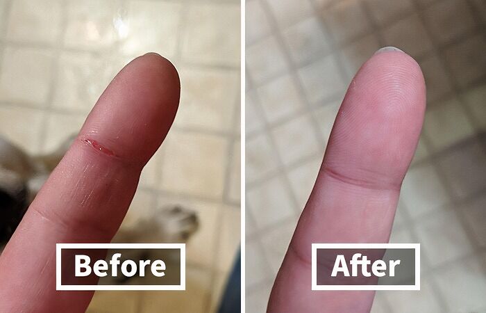 Close-up of a finger before and after using items that fix things, showing a cut healed in the coolest way.