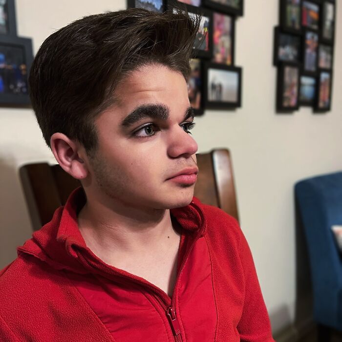 A Race Against Time: A Family's Journey With Their Child's Sanfilippo Syndrome Diagnosis