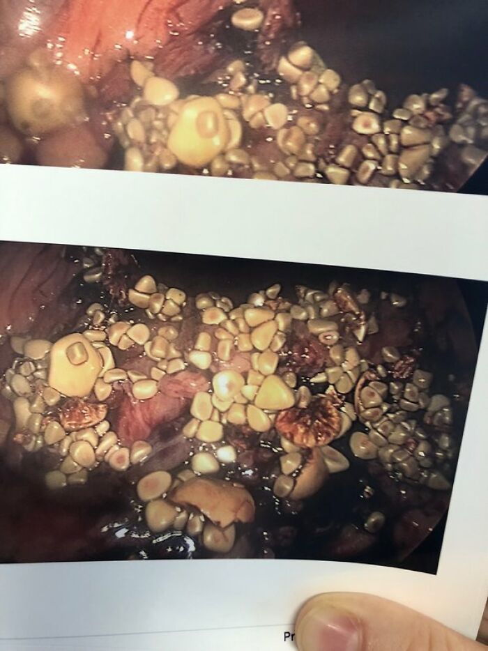 30 Times People Didn’t Think Their Symptoms Were A Big Deal, But They Were