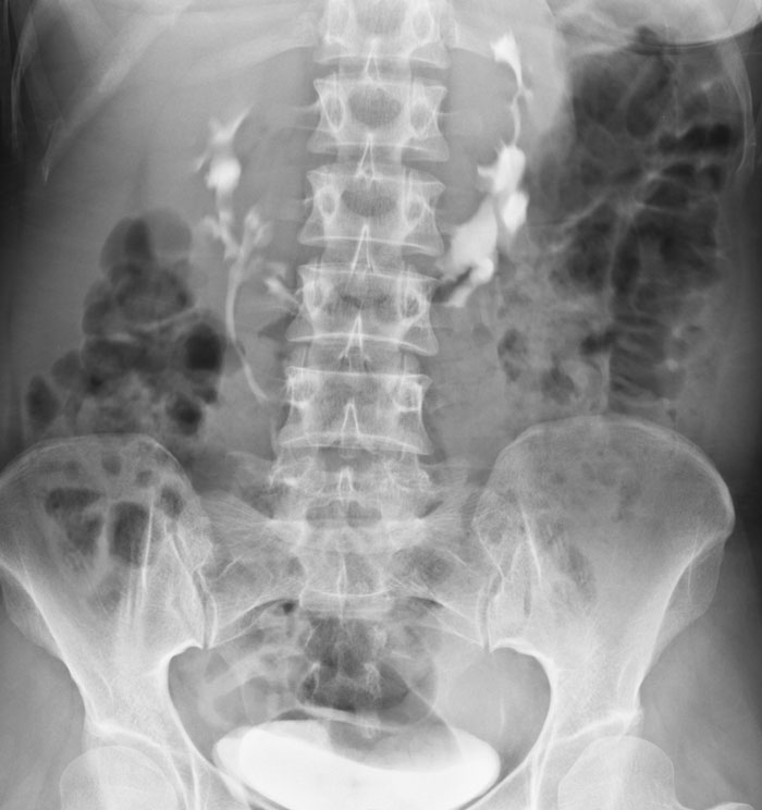 16 Científicos forenses cuentan cuál ha sido su descubrimiento más impactante