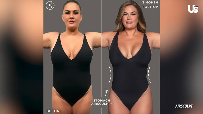 Brittany Cartwright Reveals She Got A "Revenge Body" Liposuction Before Filing For Divorce