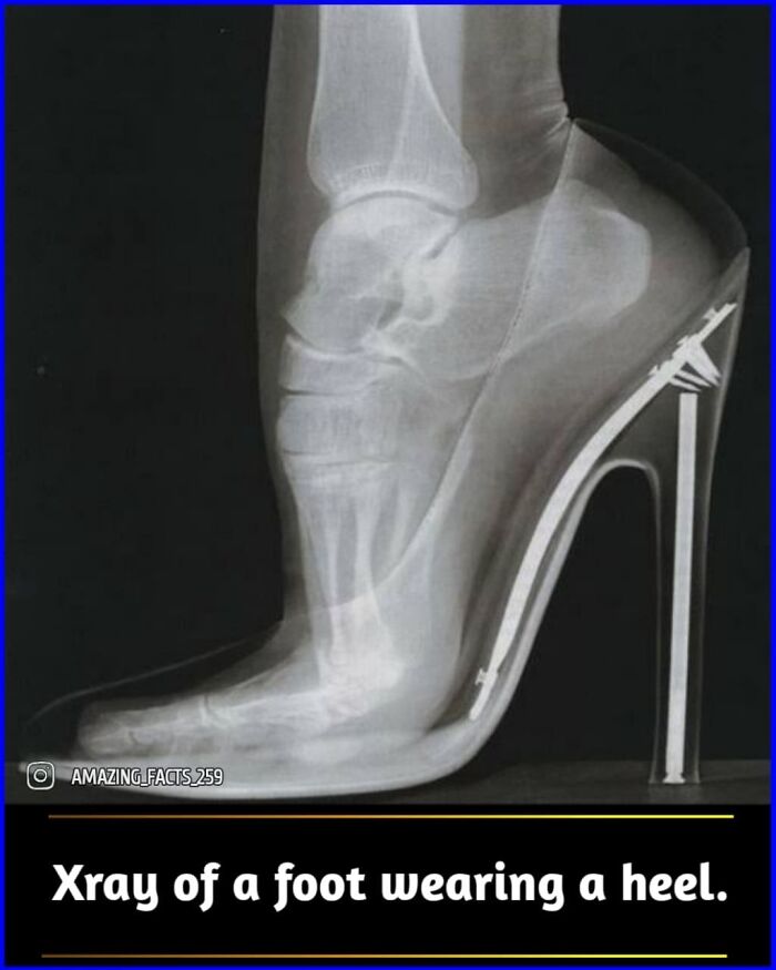 Amazing-Interesting-Facts