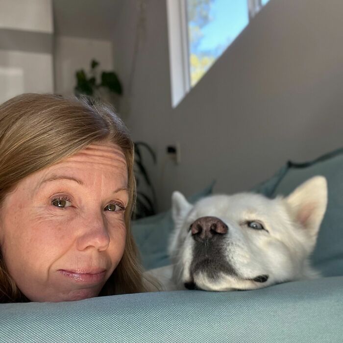 Overcoming Disability: This Dog&rsquo;s Prancing Walk Steals Hearts On The Internet