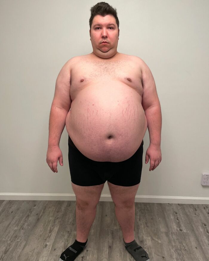 &ldquo;Y&rsquo;All Are So Stupid&rdquo;: Nikocado Avocado Stuns Viewers By Claiming His Weight Loss Was A Hoax