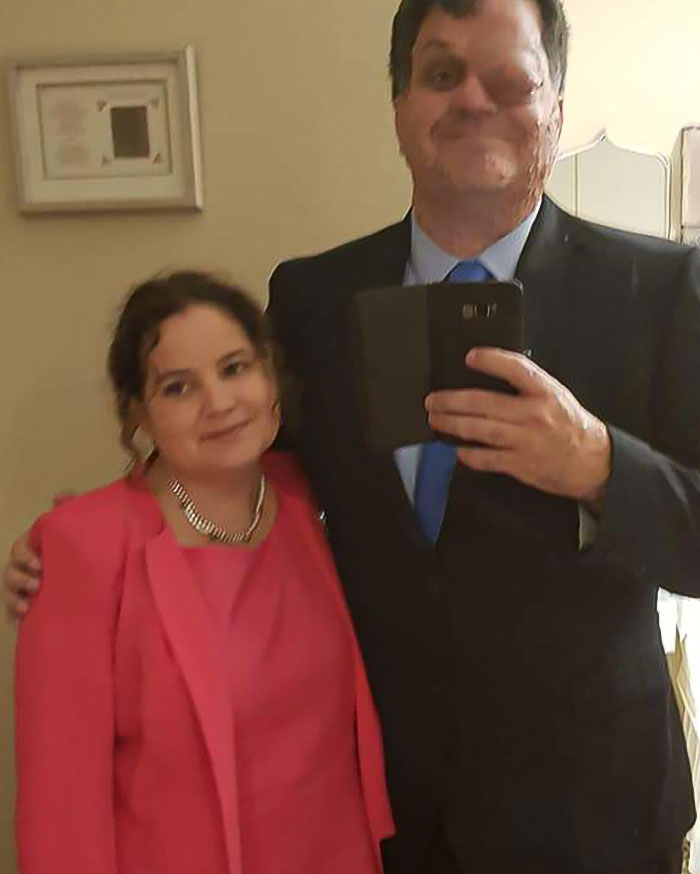 "Scaring The Customers": Man Says Restaurant Threw Him Out Because Of His Facial Disfigurement "Scaring The Customers": Man Says Restaurant Threw Him Out Because Of His Facial Disfigurement