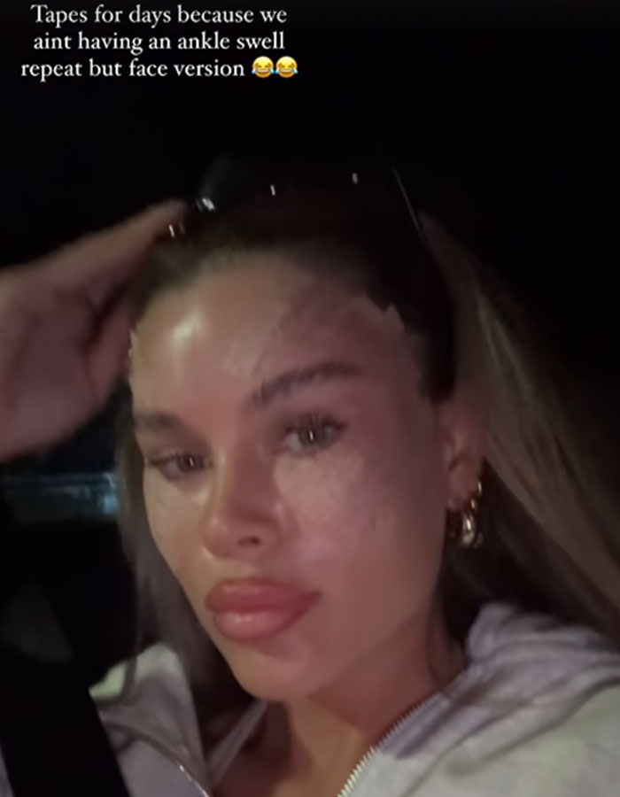 "I Hate My Appearance": Reality Star Reveals Drastically Changed Face After 'Fox Eye' Surgery