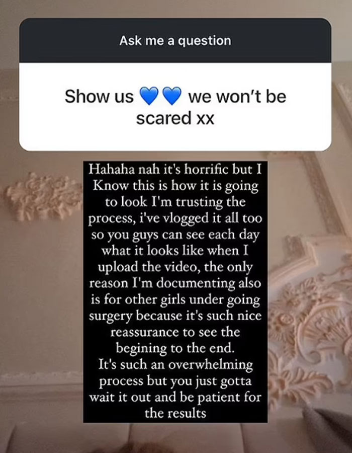 "I Hate My Appearance": Reality Star Reveals Drastically Changed Face After 'Fox Eye' Surgery