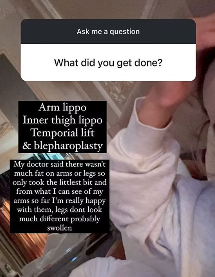 "I Hate My Appearance": Reality Star Reveals Drastically Changed Face After 'Fox Eye' Surgery